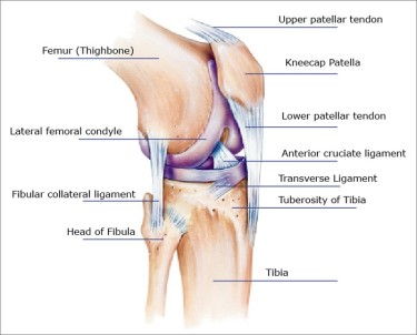 patellar tendon rupture[1]