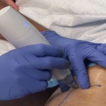 freeze knee nerve